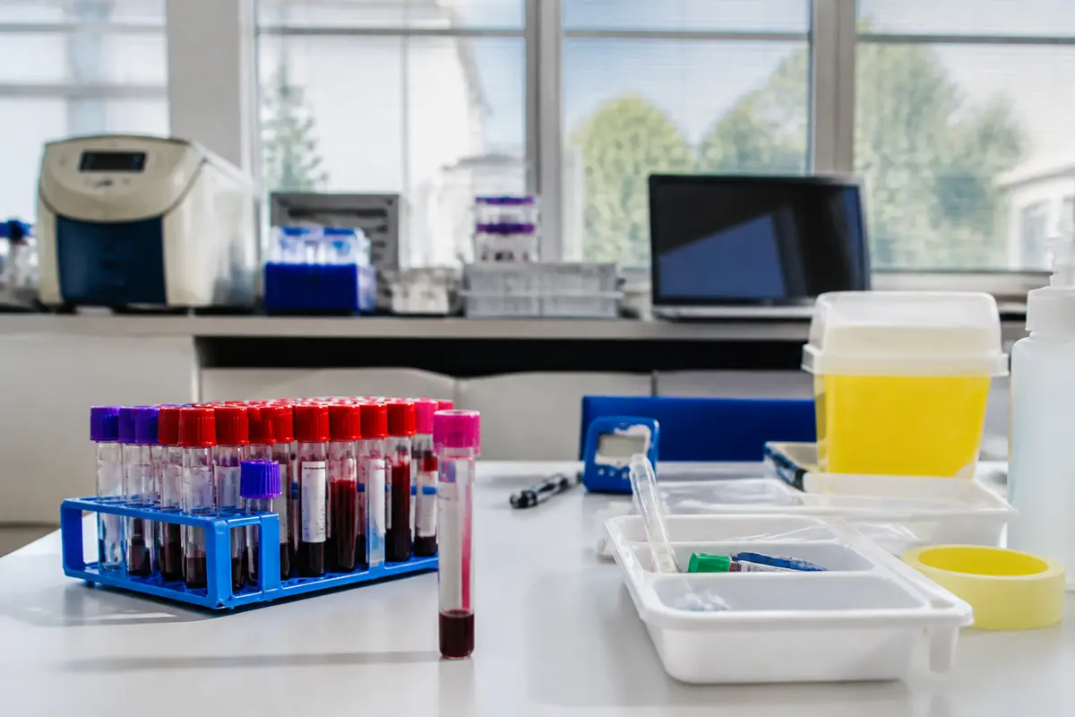 Dosage du cortisol à 8h à jeun : Comprendre les résultats !