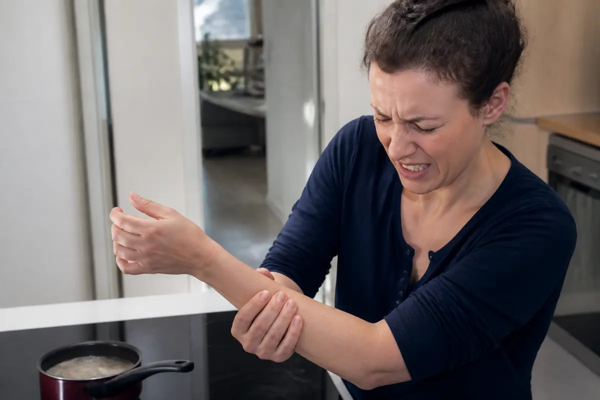 Femme souffrant de brûlure au bras droit dans la cuisine, près d'une casserole bouillante.